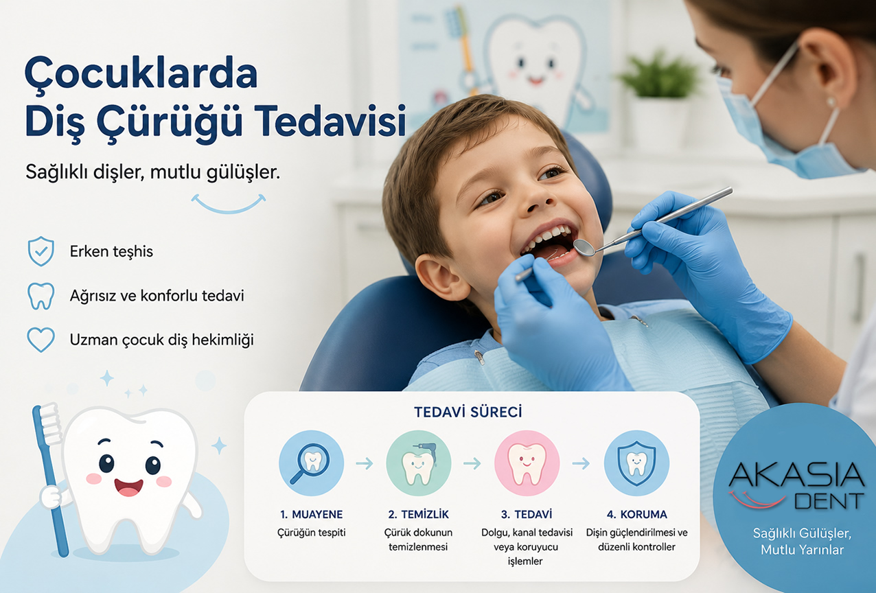 Çocuklarda Diş Çürüğü Tedavisi: Süt Dişleri Neden Önemlidir?